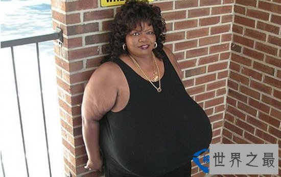 世界上最大的乳房：双胸重达38.5公斤