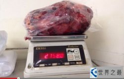 世界上最大的肾脏：重达5千克