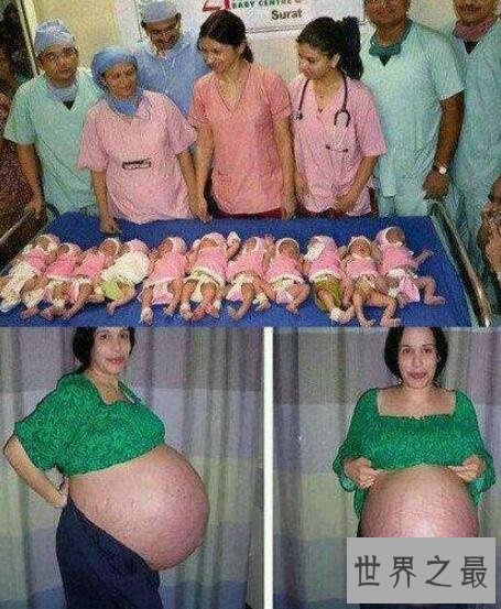 印度女子产下十一胞胎