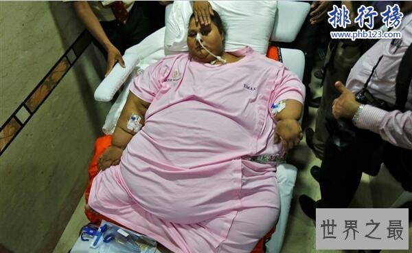 全球最胖女性去世:艾提曾重达1000斤,25年来无法下床(图)