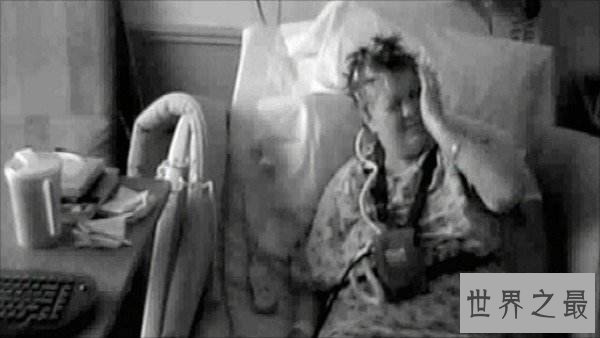 世界十大罕见病:一种变成活死人一种变成蓝血人