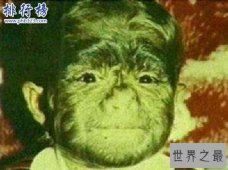 世界上最著名的兽孩:狼女卡玛拉 不穿衣服和猫狗为伴