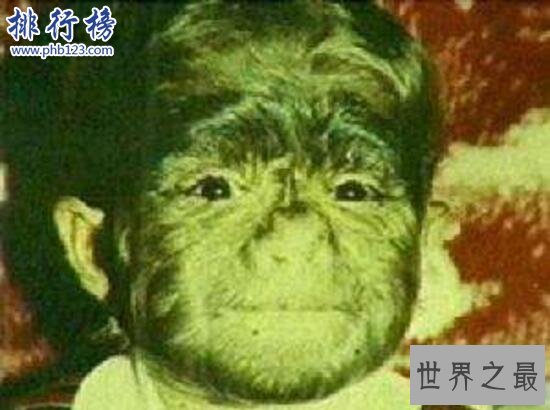 世界上最著名的兽孩:狼女卡玛拉 不穿衣服和猫狗为伴