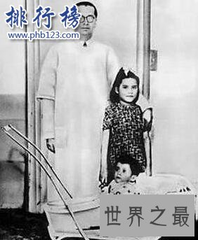 世界上最小的婴儿:体重仅200多克,小袋洗衣粉都比他重