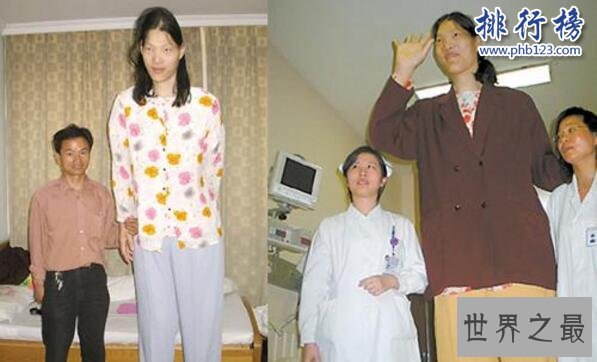 中国最高的女人是谁,姚德芬身高2.4米(脚长45.5厘米)
