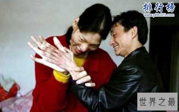 中国最高的女人是谁,姚德芬身高2.4米(脚长45.5厘米)