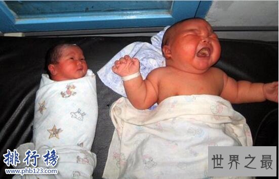 世界上最高的婴儿:印尼婴儿体长62厘米17.4斤