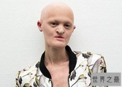 世界上最丑的名模：梅勒妮·盖多斯 没牙齿头发像外星人