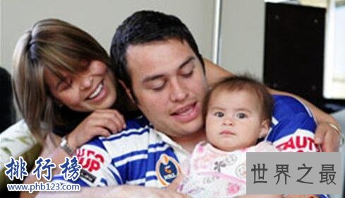 世界上肾最多的人