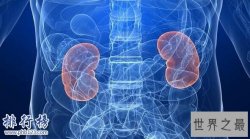 世界上肾最多的人 可以换5部iPhoneX了！