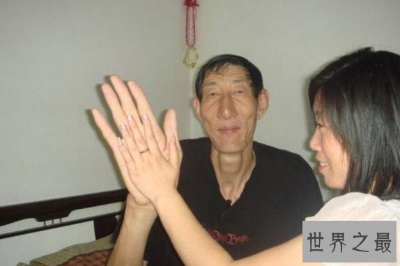 世界上最长的手:鲍喜顺手掌长38厘米,如蒲扇般大小