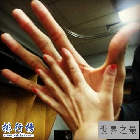 世界上最长的手:鲍喜顺手掌长38厘米,如蒲扇般大小