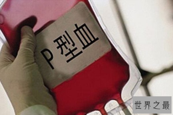 世界上最稀有的血型排名 P血型