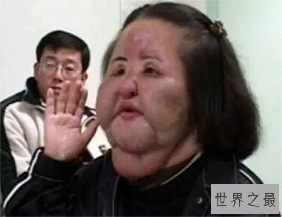 世界上最丑的十个女人排行榜