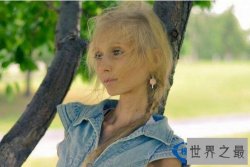 世界上最瘦的人，俄罗斯女孩高158cm重20公斤