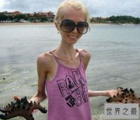 世界上最瘦的人排行榜，蒂塔万提斯排名第五（性感16寸腰）