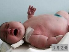 世界上出生最重的婴儿，澳大利亚产妇诞下37斤巨婴