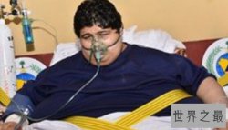 世界上最重的人排行榜，美国一男子体重635公斤（食量惊人）