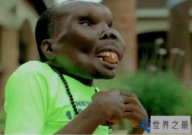 世界上最丑的男人 47岁竟成为8个孩子的父亲