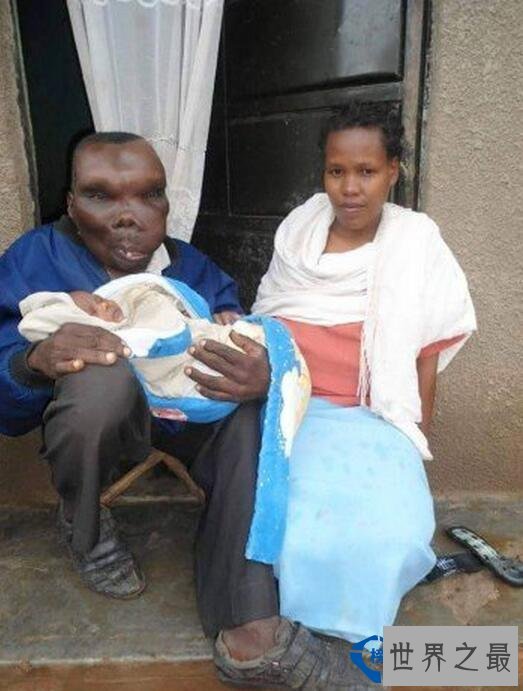 世界上最丑的男人 47岁竟成为8个孩子的父亲