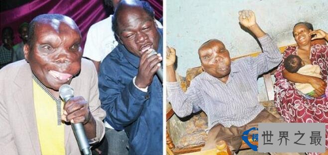 世界上最丑的男人 47岁竟成为8个孩子的父亲