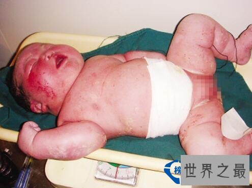 世界上最重的女婴 母亲孩子体重超标