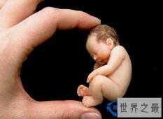 世界上最早产的婴儿 母亲怀孕仅6个月