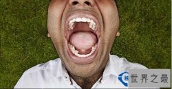 世界上有最多牙齿的人 牙齿多达三十多颗