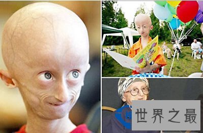 盘点世界上各个角落的人体“之最”