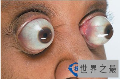 盘点世界上各个角落的人体“之最”