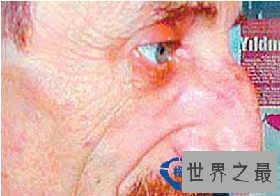 盘点世界上各个角落的人体“之最”