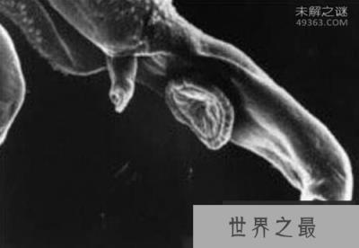 吸血虫,与人类纠缠千万年(吸人血,吃人腐肉)