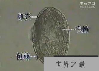 吸血虫,与人类纠缠千万年(吸人血,吃人腐肉)