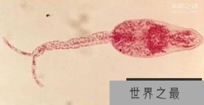 吸血虫,与人类纠缠千万年(吸人血,吃人腐肉)