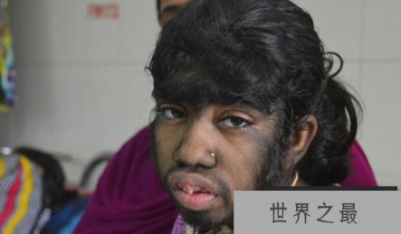 揭秘狼孩的故事,最真实的狼孩习性竟与狼相似