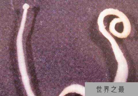 世界十大恶心的寄生虫