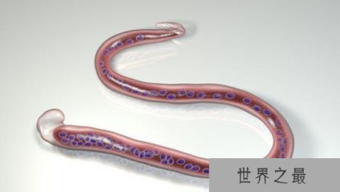 世界十大恶心的寄生虫