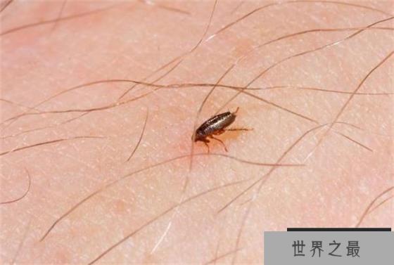 世界上弹跳能力最好的昆虫 跳高30厘米左右(跳蚤)