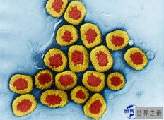 导致上亿人死亡的世界十大恐怖病毒，您了解几种？