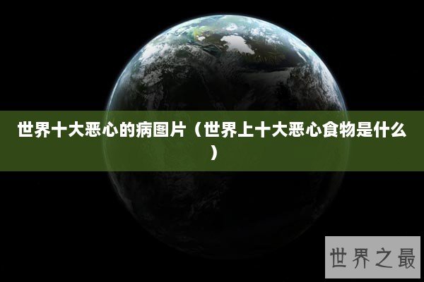 世界十大恶心的病图片（世界上十大恶心食物是什么）