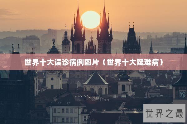 世界十大误诊病例图片（世界十大疑难病）