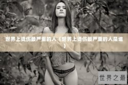 世界上烫伤最严重的人（世界上烫伤最严重的人是谁）