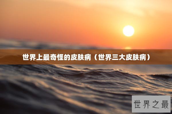 世界上最奇怪的皮肤病（世界三大皮肤病）