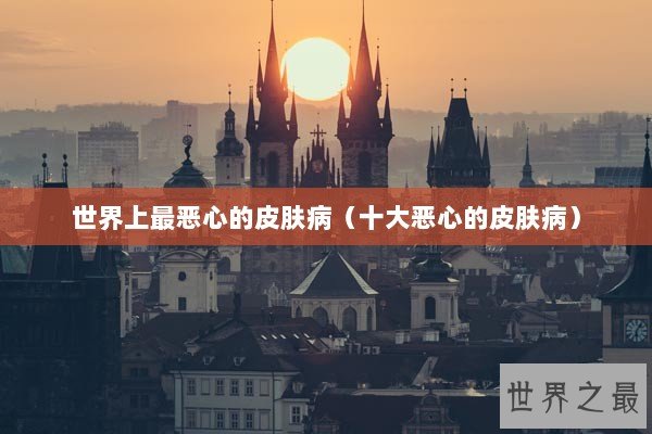 世界上最恶心的皮肤病（十大恶心的皮肤病）