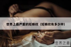 世界上最严重的妊娠纹（妊娠纹有多少种）