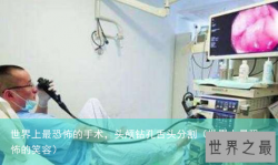 世界上最恐怖的手术，头颅钻孔舌头分割（世界上最恐怖的笑容）