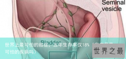 世界上最可怕的癌症，五年生存率仅18%（癌症是最可怕的疾病吗）