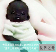 世界上最黑的孩子，因全身皮肤黝黑而受到质疑（世界上最黑的孩子现在怎么样了）