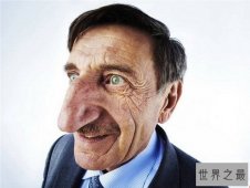 【图】世界上最大的鼻子