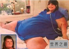 【图】八个世界上最胖的人 最胖的体重达727公斤！